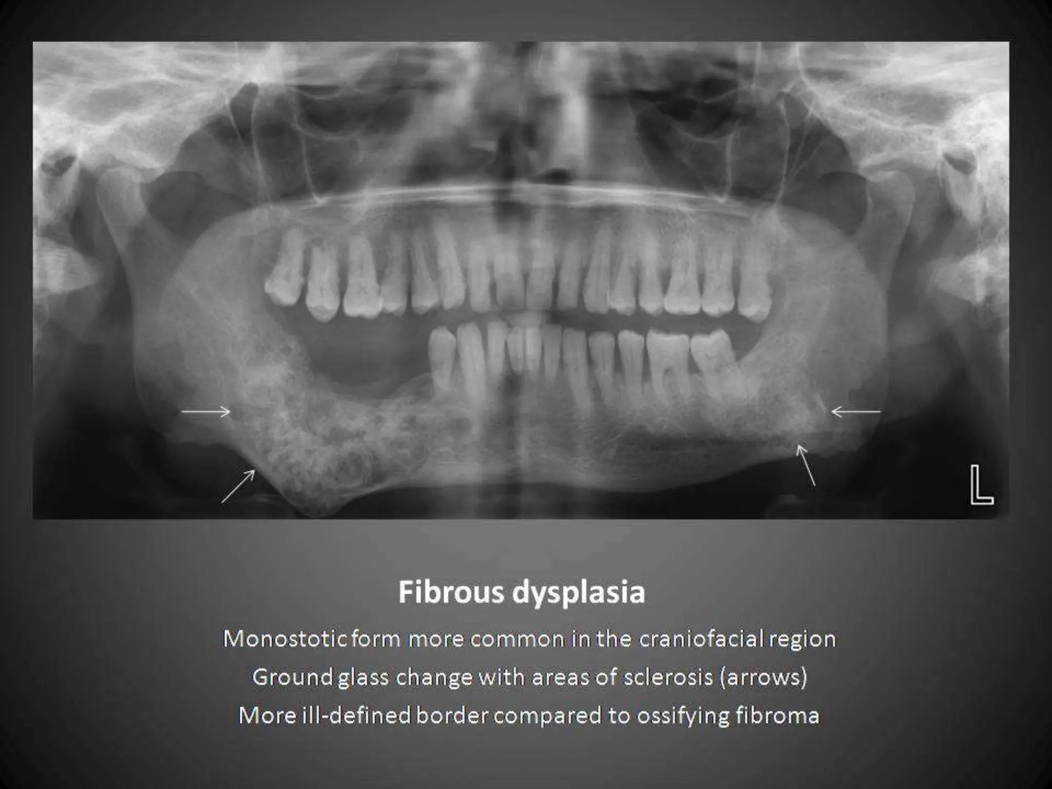 45   Free PowerPoint Template from www.brainybetty.com   11/15/2011
 