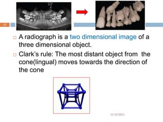 12



        A radiograph is a two dimensional image of a
         three dimensional object.
        Clark’s rule: The most distant object from the
         cone(lingual) moves towards the direction of
         the cone




                                        11/15/2011
 