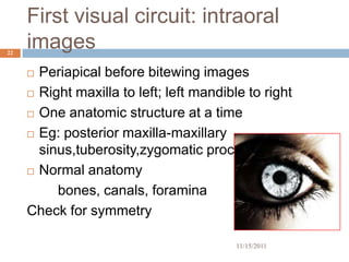 First visual circuit: intraoral
22
     images
      Periapical before bitewing images
      Right maxilla to left; left mandible to right

      One anatomic structure at a time

      Eg: posterior maxilla-maxillary

       sinus,tuberosity,zygomatic process
      Normal anatomy

          bones, canals, foramina
     Check for symmetry

                                          11/15/2011
 