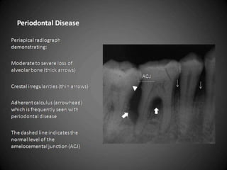 26   Free PowerPoint Template from www.brainybetty.com   11/15/2011
 