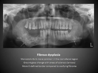 45   Free PowerPoint Template from www.brainybetty.com   11/15/2011
 