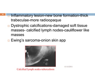 46
        Inflammatory lesion-new bone formation-thick
         trabeculae-more radioopaque
        Dystrophic calcifications-damaged soft tissue
         masses- calcified lymph nodes-cauliflower like
         masses
        Ewing’s sarcoma-onion skin app




                                                 11/15/2011
            Calcified lymph nodes-tuberculosis
 