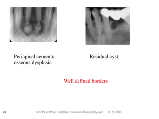 Periapical cemento                              Residual cyst
     osseous dysplasia


                                  Well defined borders




48            Free PowerPoint Template from www.brainybetty.com   11/15/2011
 