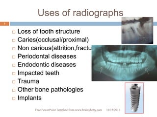 Uses of radiographs
5


       Loss of tooth structure
       Caries(occlusal/proximal)
       Non carious(attrition,fracture)
       Periodontal diseases
       Endodontic diseases
       Impacted teeth
       Trauma
       Other bone pathologies
       Implants
              Free PowerPoint Template from www.brainybetty.com   11/15/2011
 