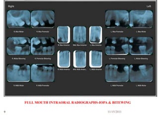 FULL MOUTH INTRAORAL RADIOGRAPHS-IOPA & BITEWING

9                                        11/15/2011
 