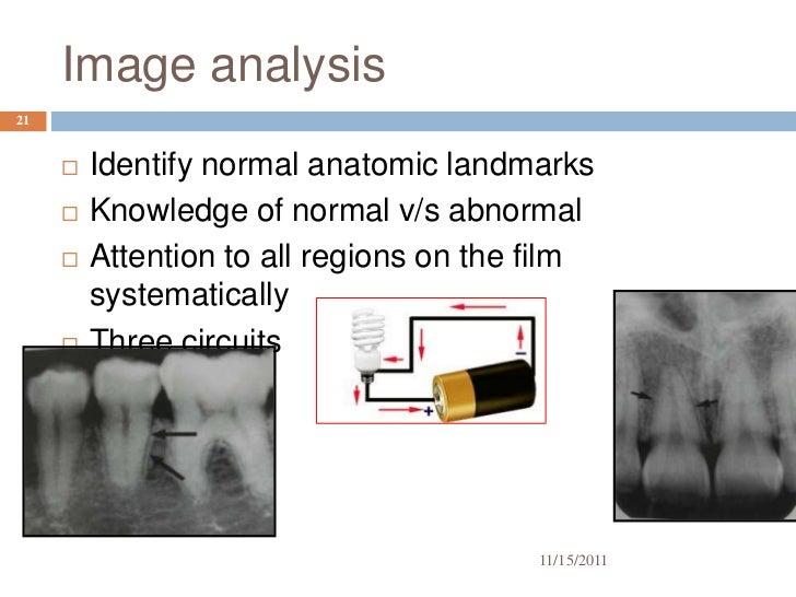 Radiographic interpretation