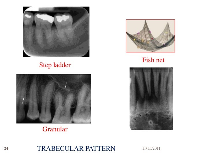 Radiographic interpretation