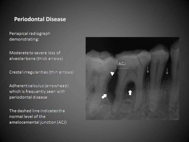 Radiographic interpretation teeth diagram labeling 