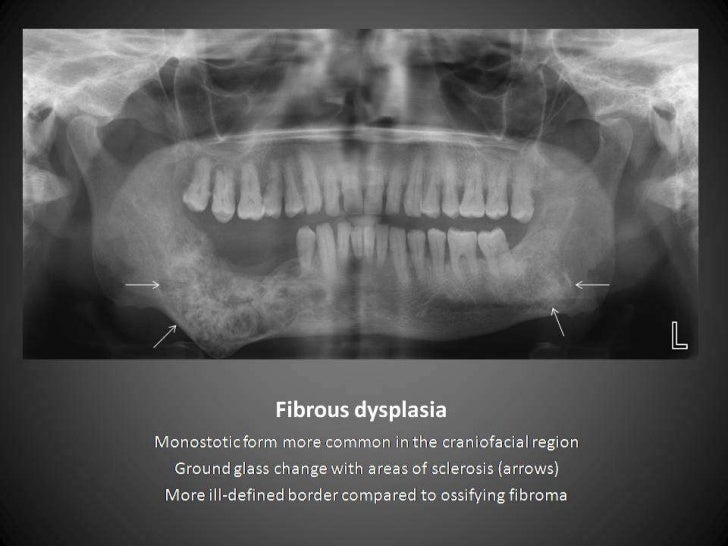 Radiographic interpretation