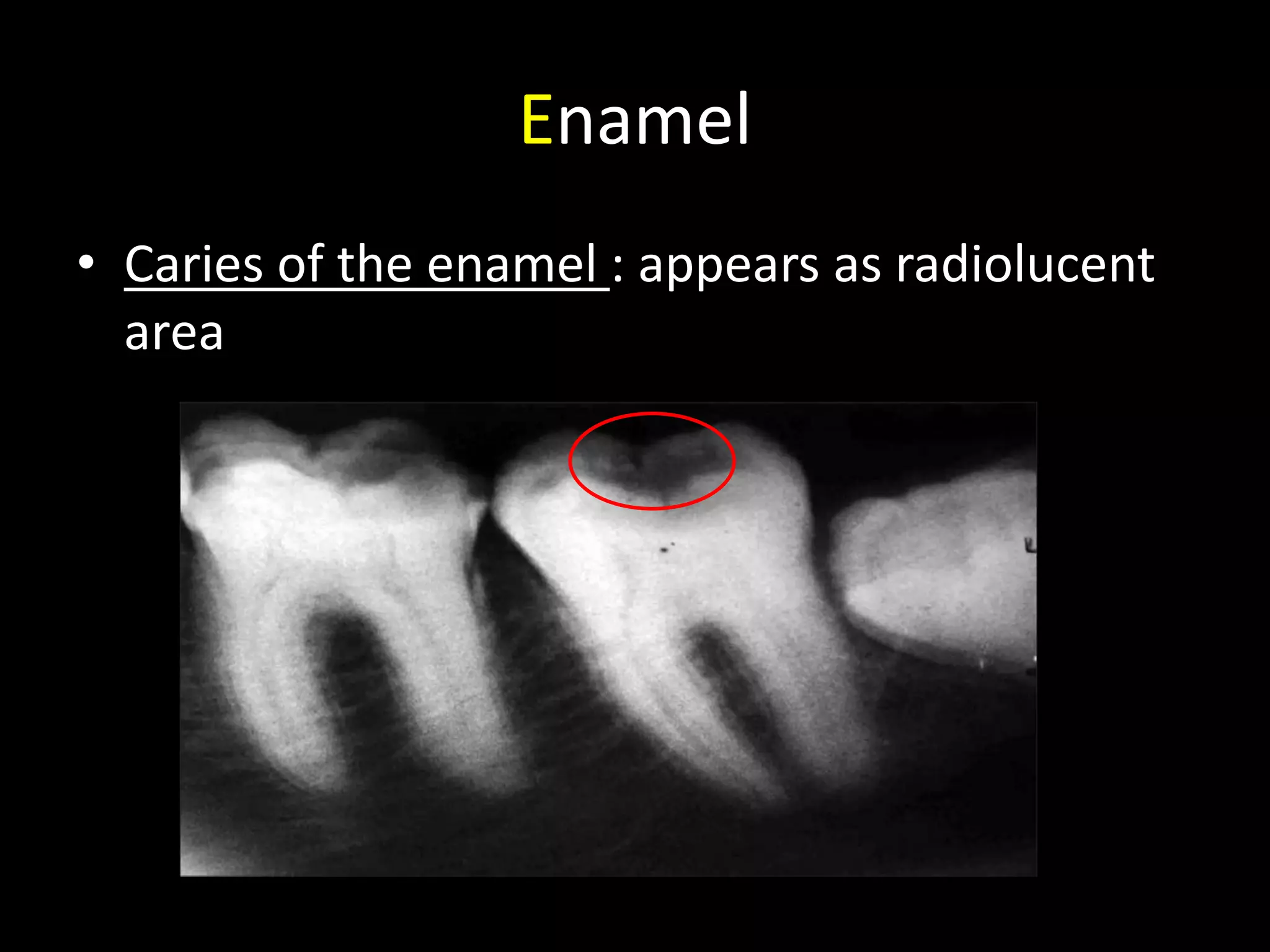 Radiographic interpretation | PPTX