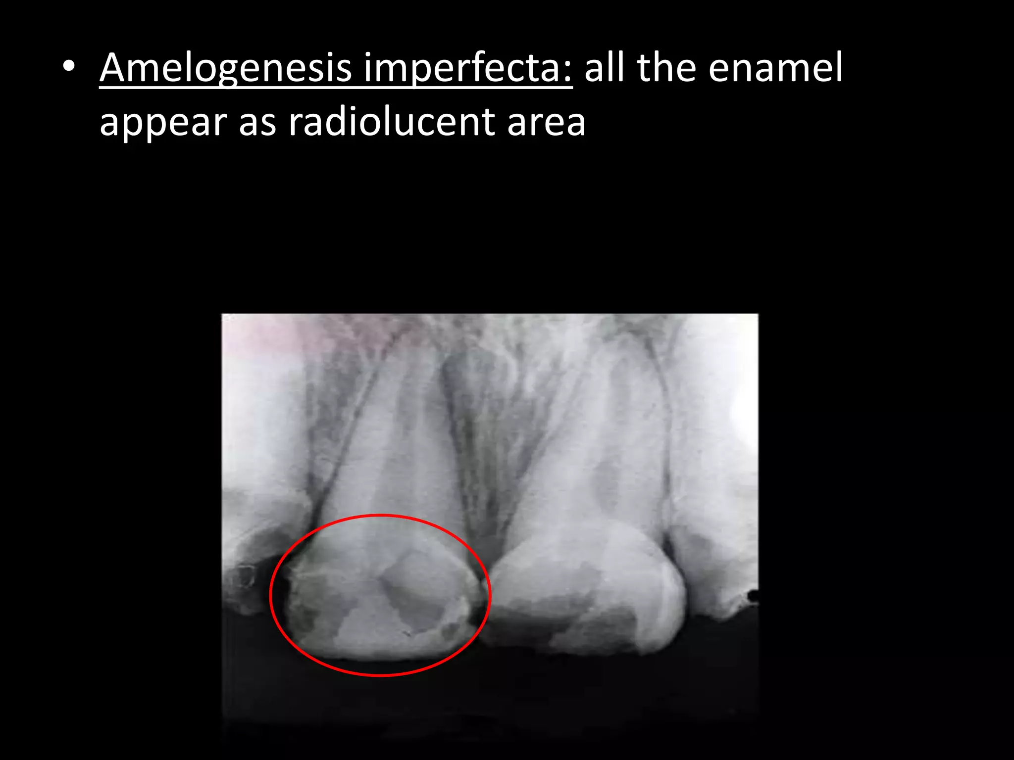 Radiographic interpretation | PPTX