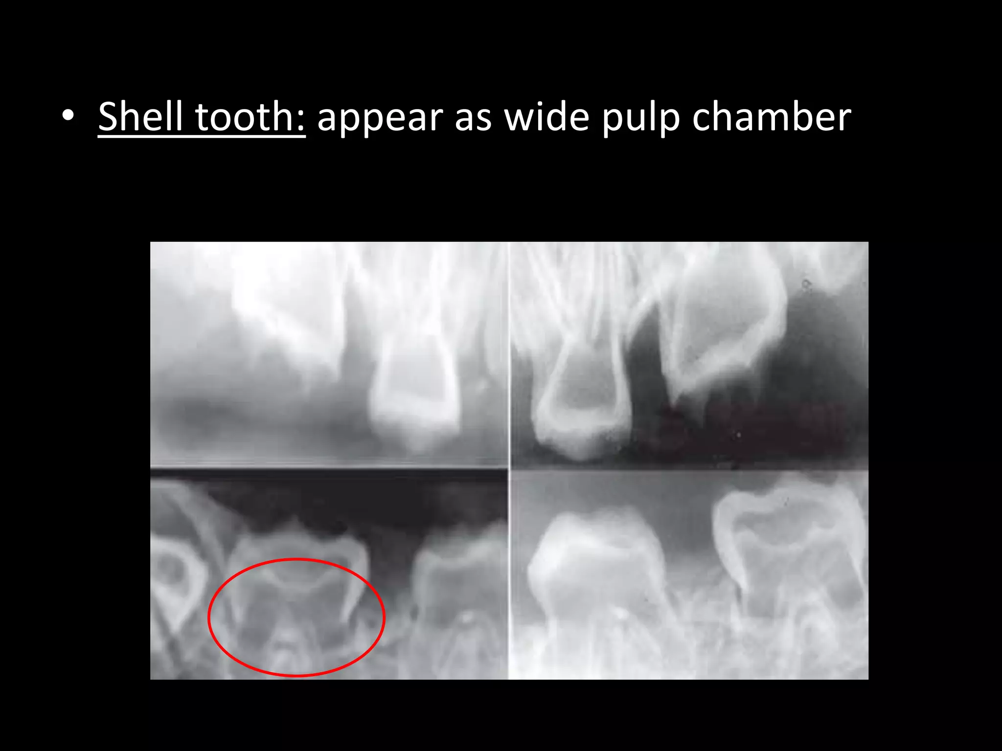 Radiographic interpretation | PPTX