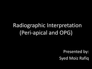 Radiographic Interpretation
(Peri-apical and OPG)
Presented by:
Syed Moiz Rafiq
 