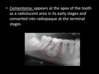 Radiographic interpretation | PPTX