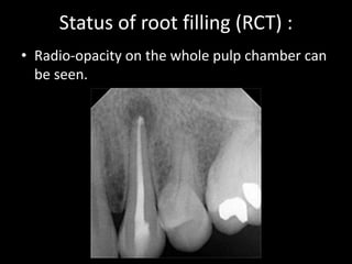 Radiographic interpretation | PPTX