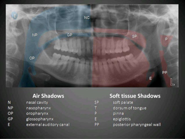 Radiographic interpretation