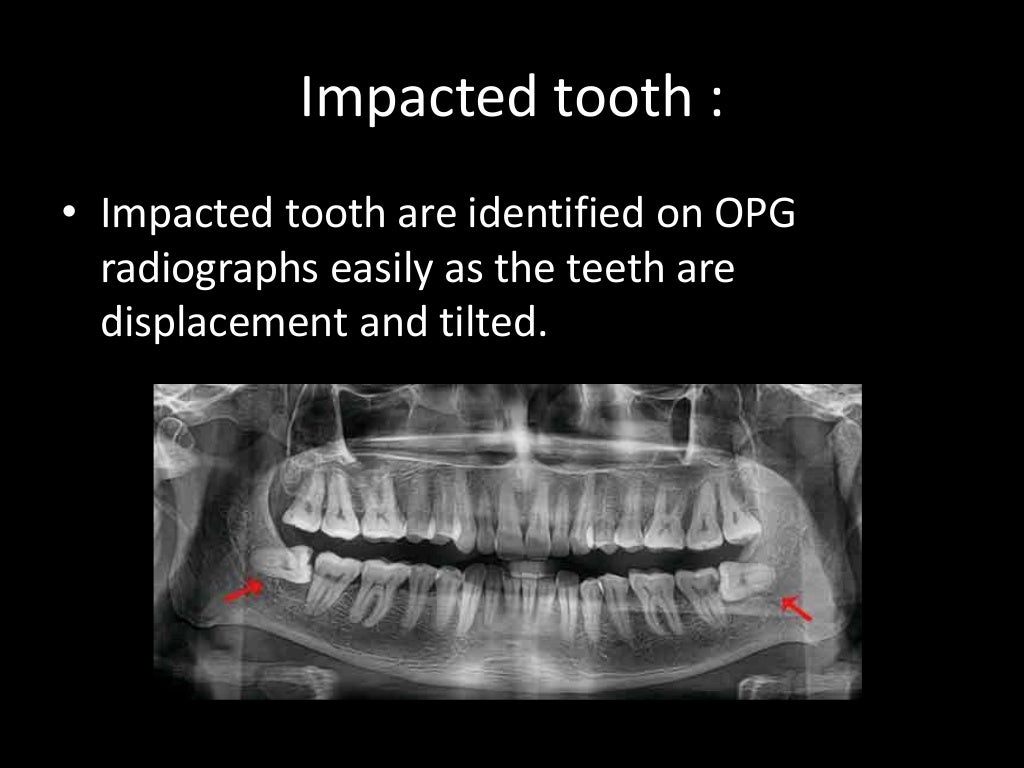 Radiographic interpretation