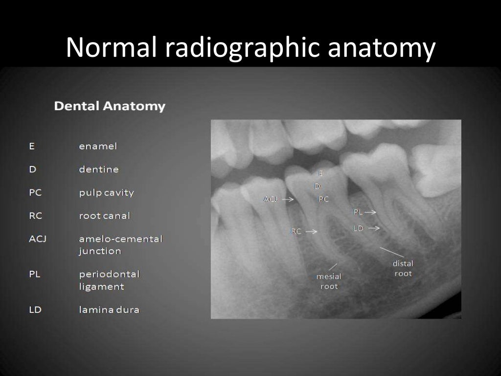 Radiographic interpretation
