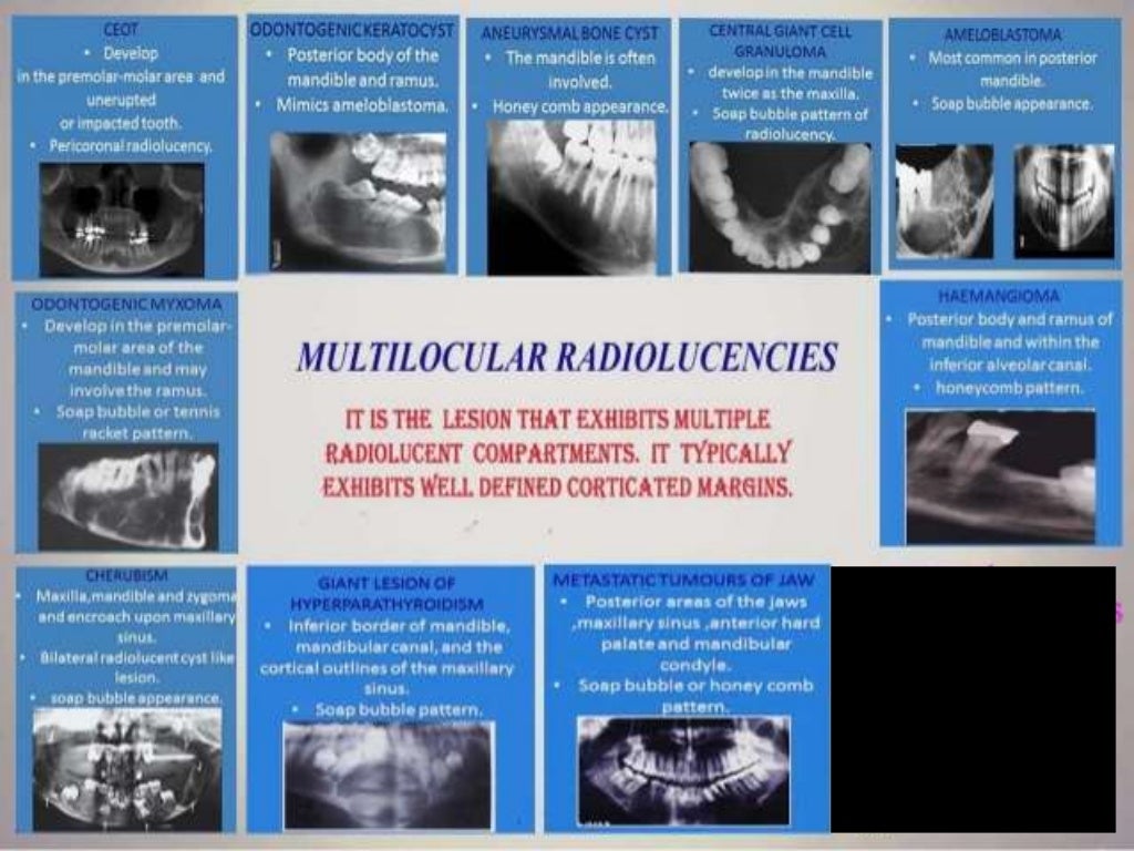 Radiographic interpretation