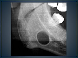Radiographic interpretation (1).pptx