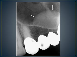 Radiographic Interpretation 1 Pptx