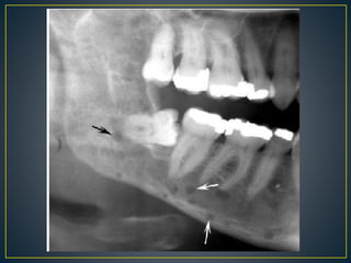 Keofeed Radiograph Radiographic interpretation (1).pptx