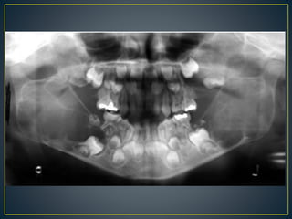 Kch Radiography Radiographic interpretation (1).pptx