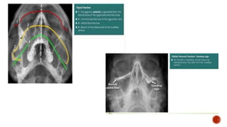 Radiographic investigations in oral and maxillofacial surgery | PPTX