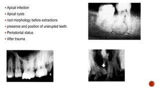 Radiographic investigations in oral and maxillofacial surgery | PPTX