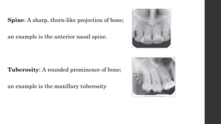 radiographic landmarks of maxilla and mandible | PPTX