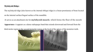 Oblique Ridge Radiography radiographic landmarks of maxilla and mandible | PPTX
