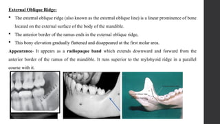 Oblique Ridge Radiography radiographic landmarks of maxilla and mandible | PPTX