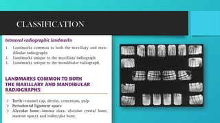 Positioning Landmarks Radiography RADIOGRAPHIC LANDMARKS .pptx