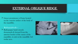 Oblique Ridge Radiography RADIOGRAPHIC LANDMARKS .pptx