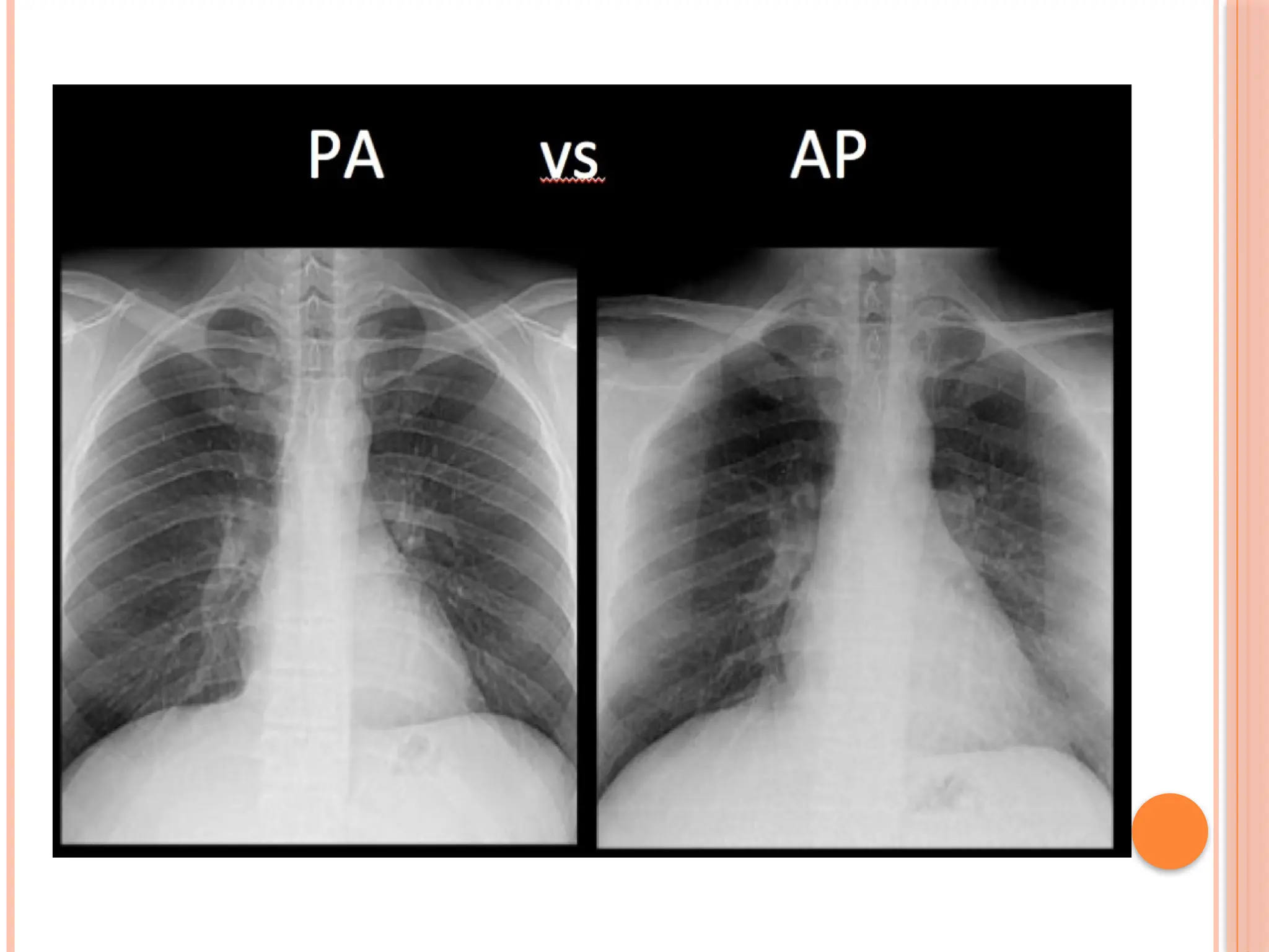 Radiographic Landmarks in Evaluating Chest Radiography.pptx