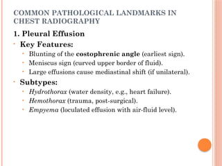 Radiographic Landmarks in Evaluating Chest Radiography.pptx