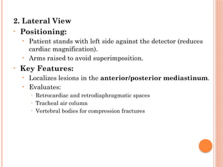 Positioning Landmarks Radiography Radiographic Landmarks in Evaluating Chest Radiography.pptx