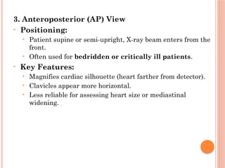 Positioning Landmarks Radiography Radiographic Landmarks in Evaluating Chest Radiography.pptx
