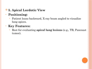 Lindblom Method Radiographic Landmarks in Evaluating Chest Radiography.pptx