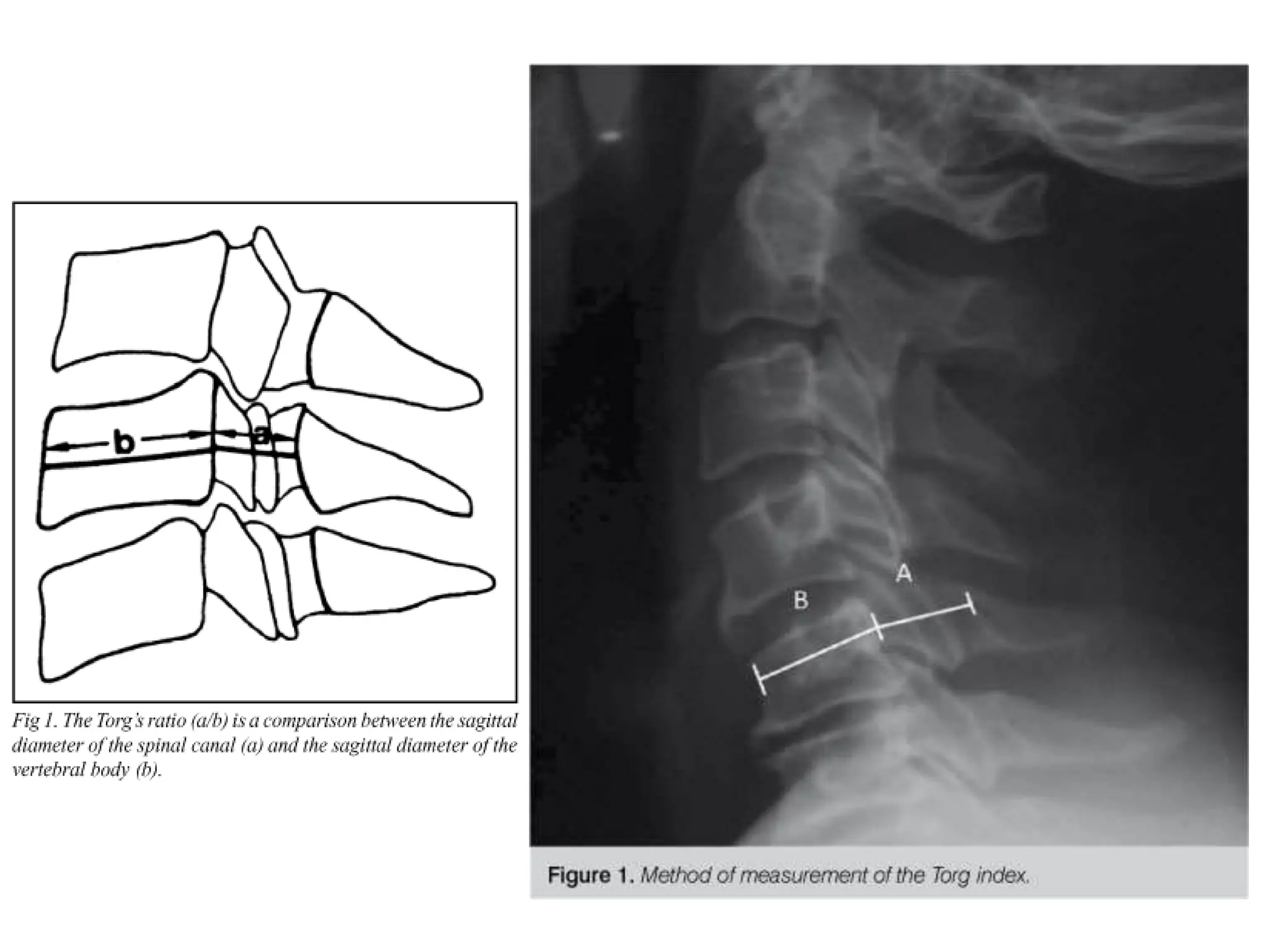 Radiographic lines and angles | PPTX