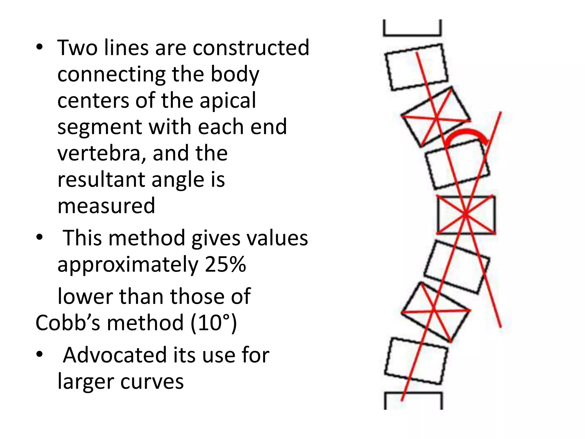 Radiographic lines and angles | PPTX