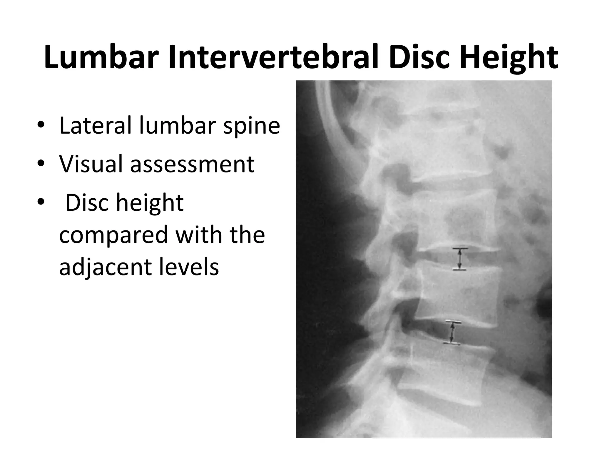 Radiographic lines and angles | PPTX