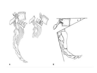 Radiographic lines and angles | PPTX