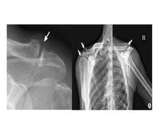 Radiographic lines and angles | PPTX