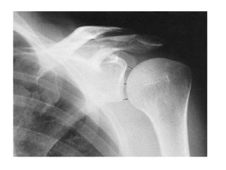 Radiographic lines and angles | PPTX
