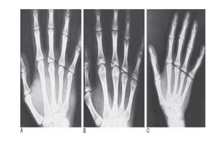 Radiographic lines and angles | PPTX