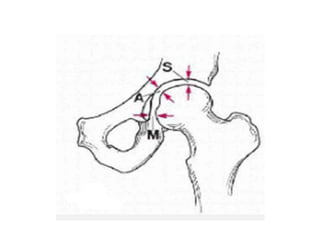 Radiographic lines and angles | PPTX