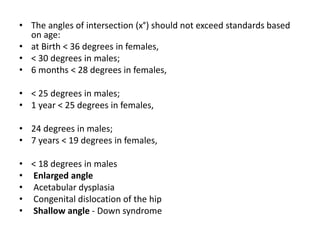 Radiographic lines and angles | PPTX