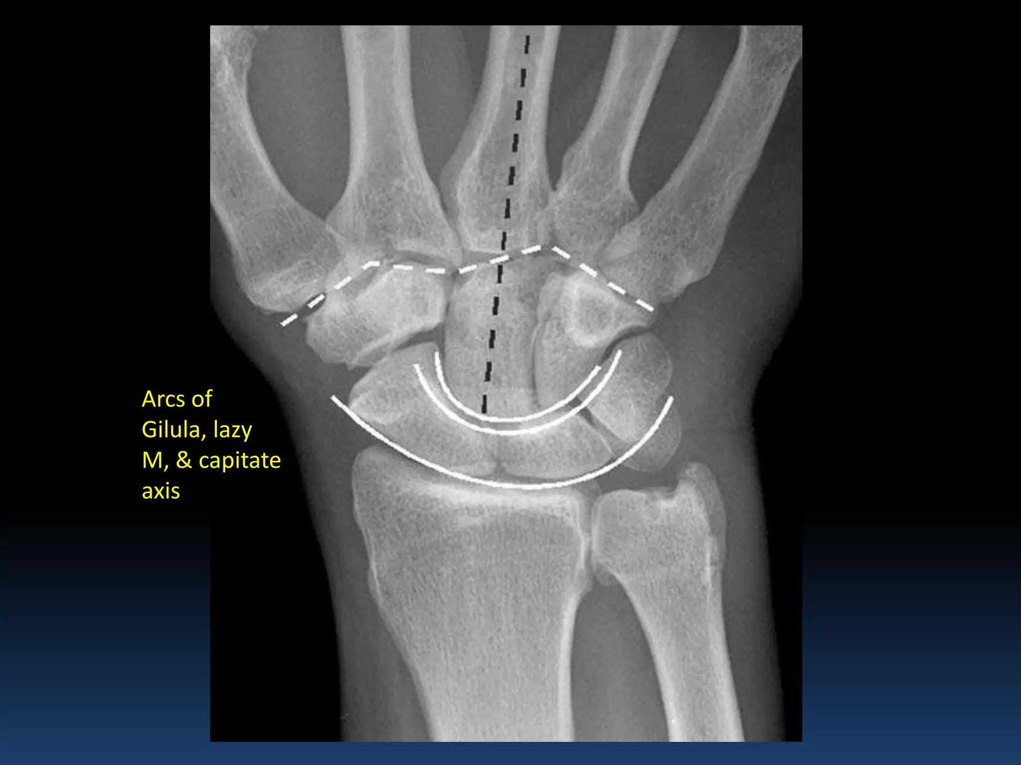 Radiographic MSK Anatomy | PPT