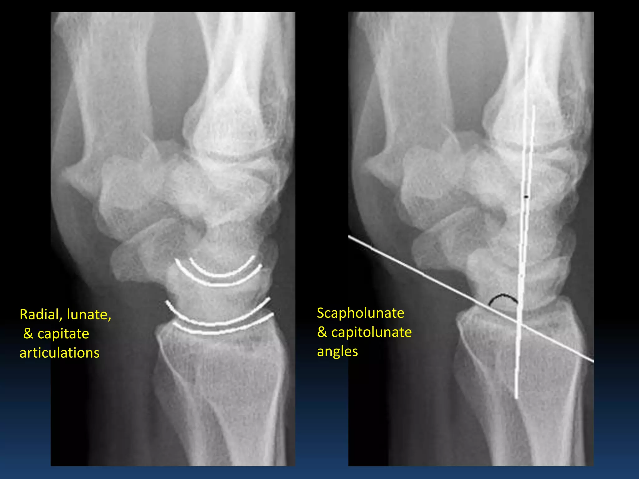 Radiographic MSK Anatomy | PPT